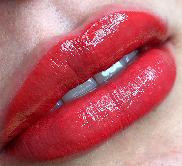 Rote Lippen nach einer PhiContour Behandlung